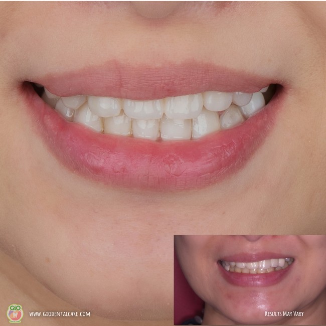 get-your-smile-here--1
